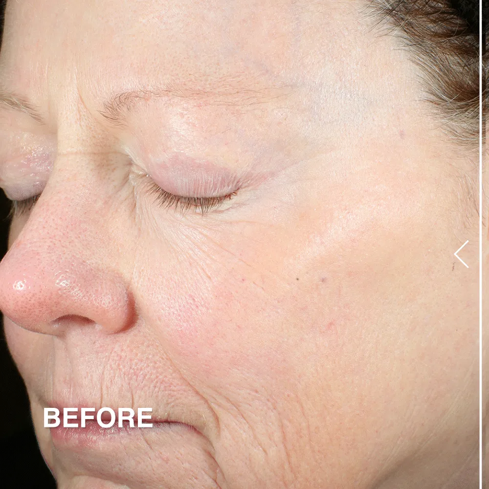 Advanced Peptides & Flora-Collagen™ Night Moisturizer