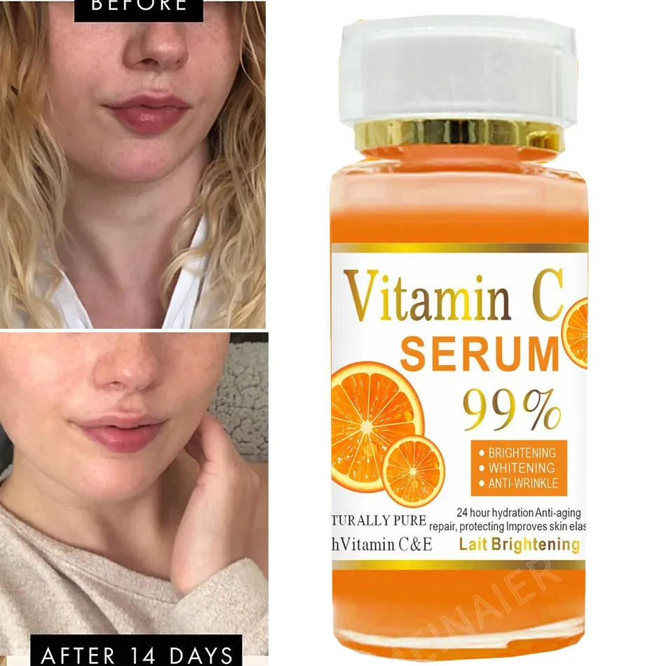 Advanced Vitamin C Glow Serum with AHA, Kojic Acid & Glutathione – 120ml Premium Skin Brightening & Anti-Aging Formula for Dark Spots, Wrinkles, and Radiant Skin