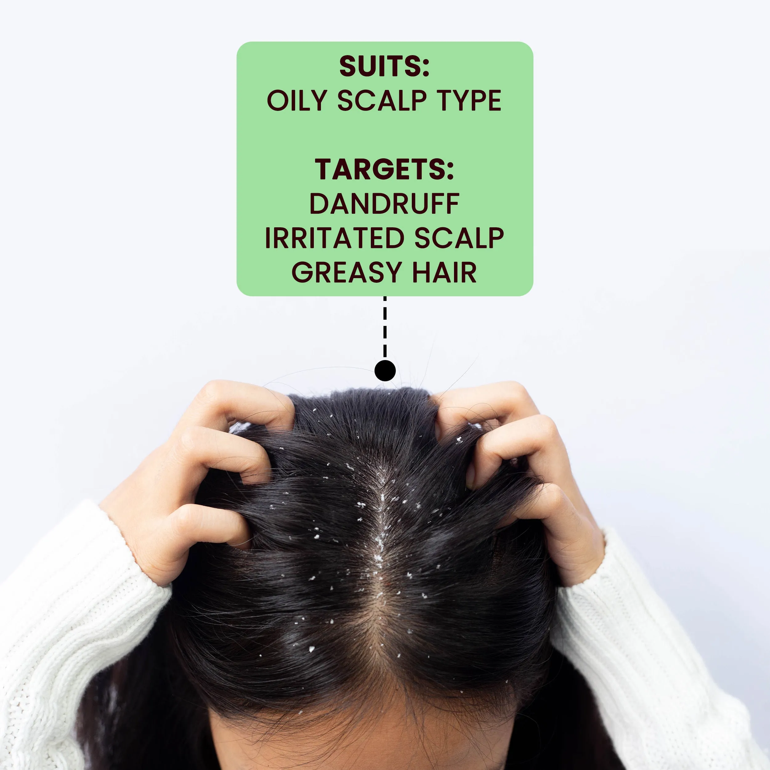 Alps Goodness Tea Tree Oil, Hyaluronic Acid & Ketoconazole Anti Dandruff Scalp Serum For Oily Scalp (30 ml)