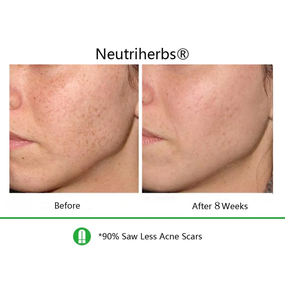 Best Duo For Dull Skin with Wrinkles & Dark Spots
