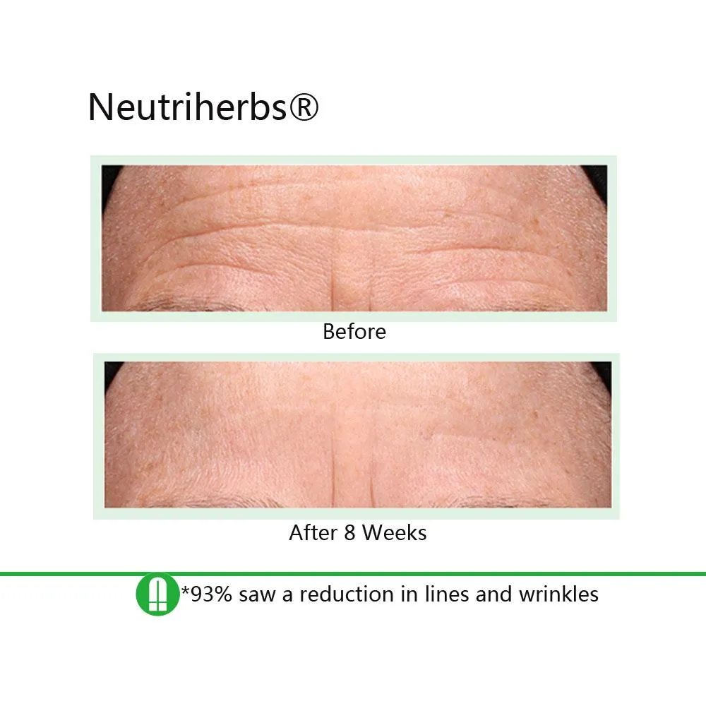 Best Duo For Dull Skin with Wrinkles & Dark Spots