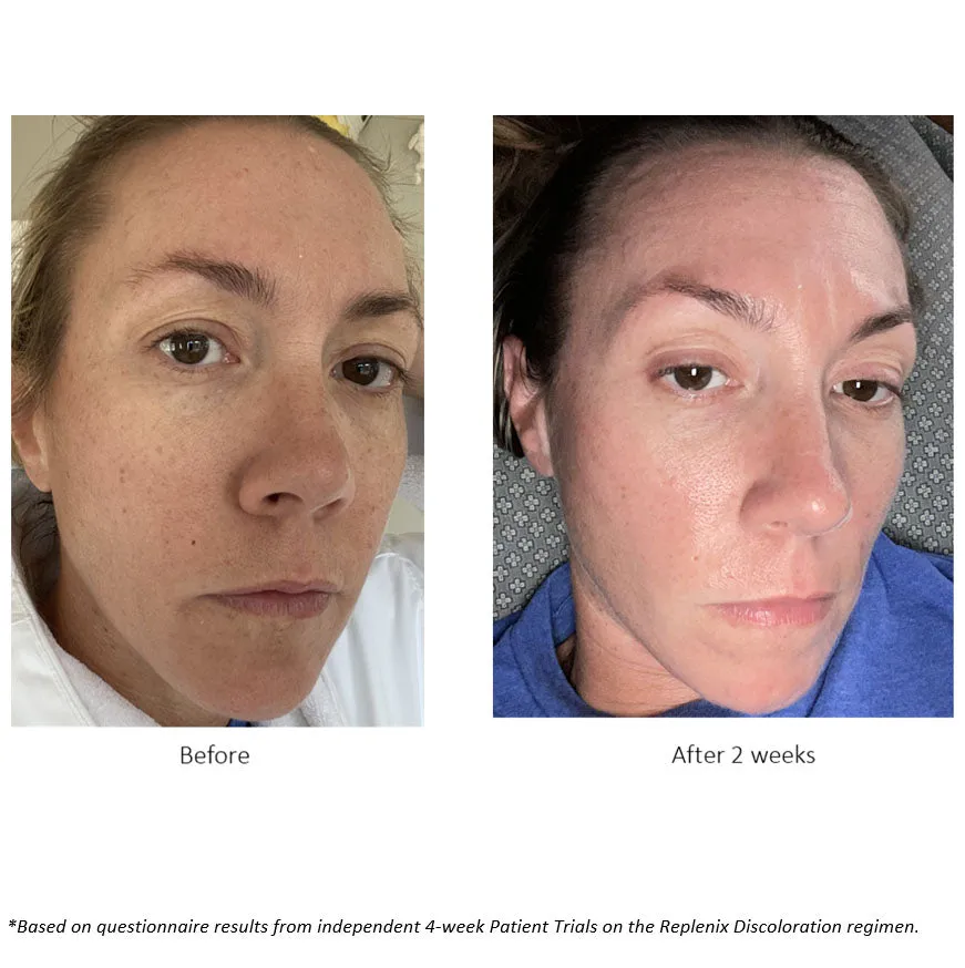 Brightening Eye Cream