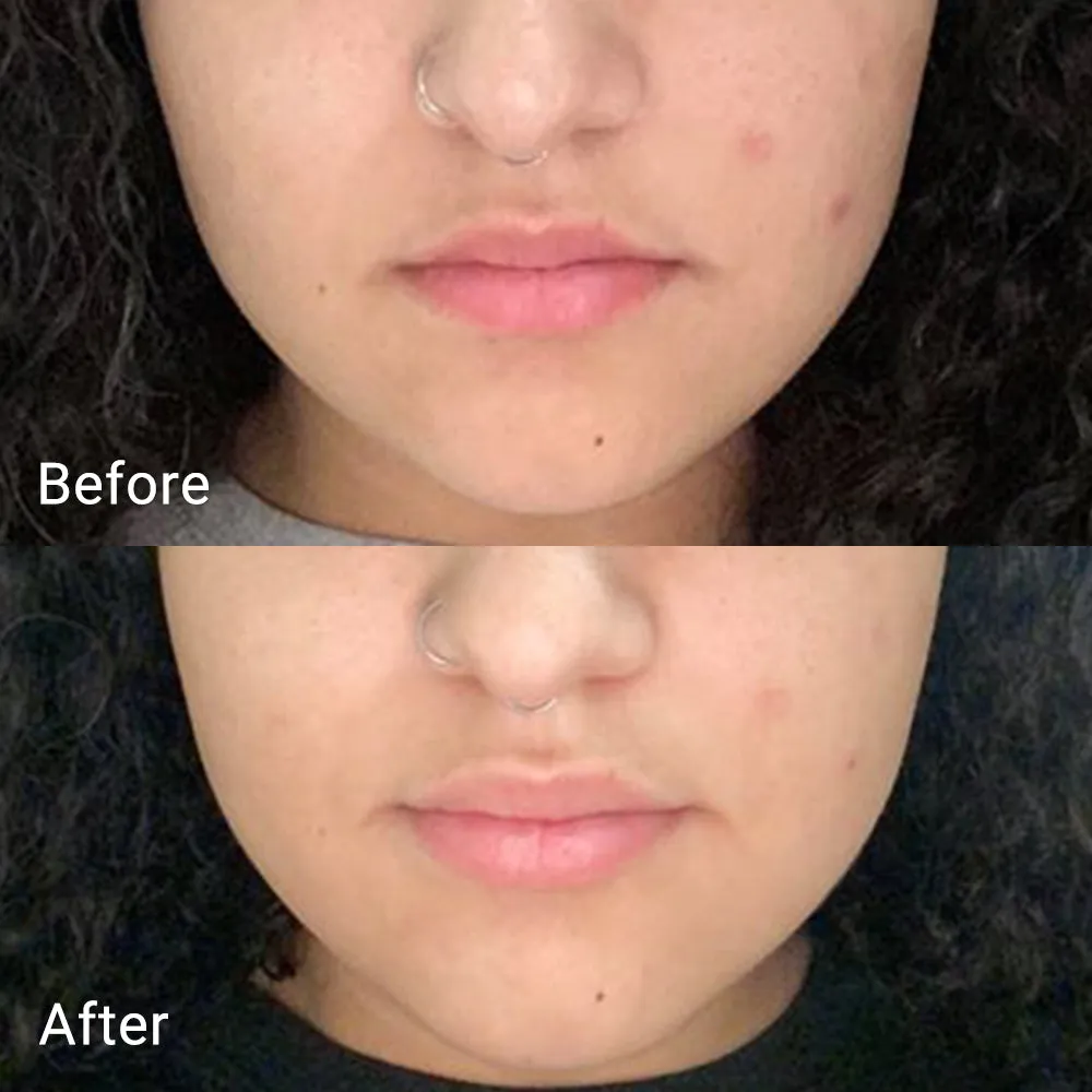 Calendula Peel Off Mask