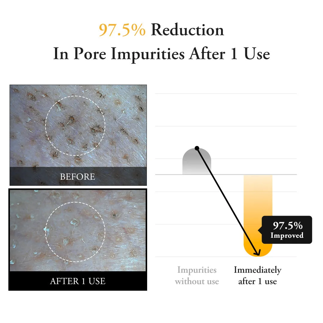 Calendula Peel Off Mask