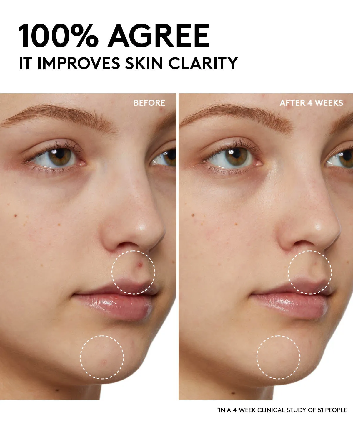 Cherry Dub Pore Purify'r Gel Cleanser with Niacinamide   Aloe Juice