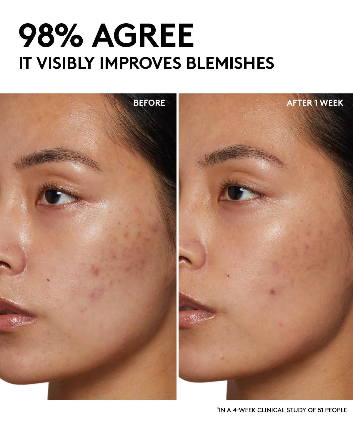 Cherry Dub Pore Purify'r Gel Cleanser with Niacinamide   Aloe Juice
