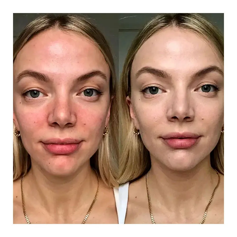 Cicapair™ Tiger Grass Color Correcting Treatment 50ml