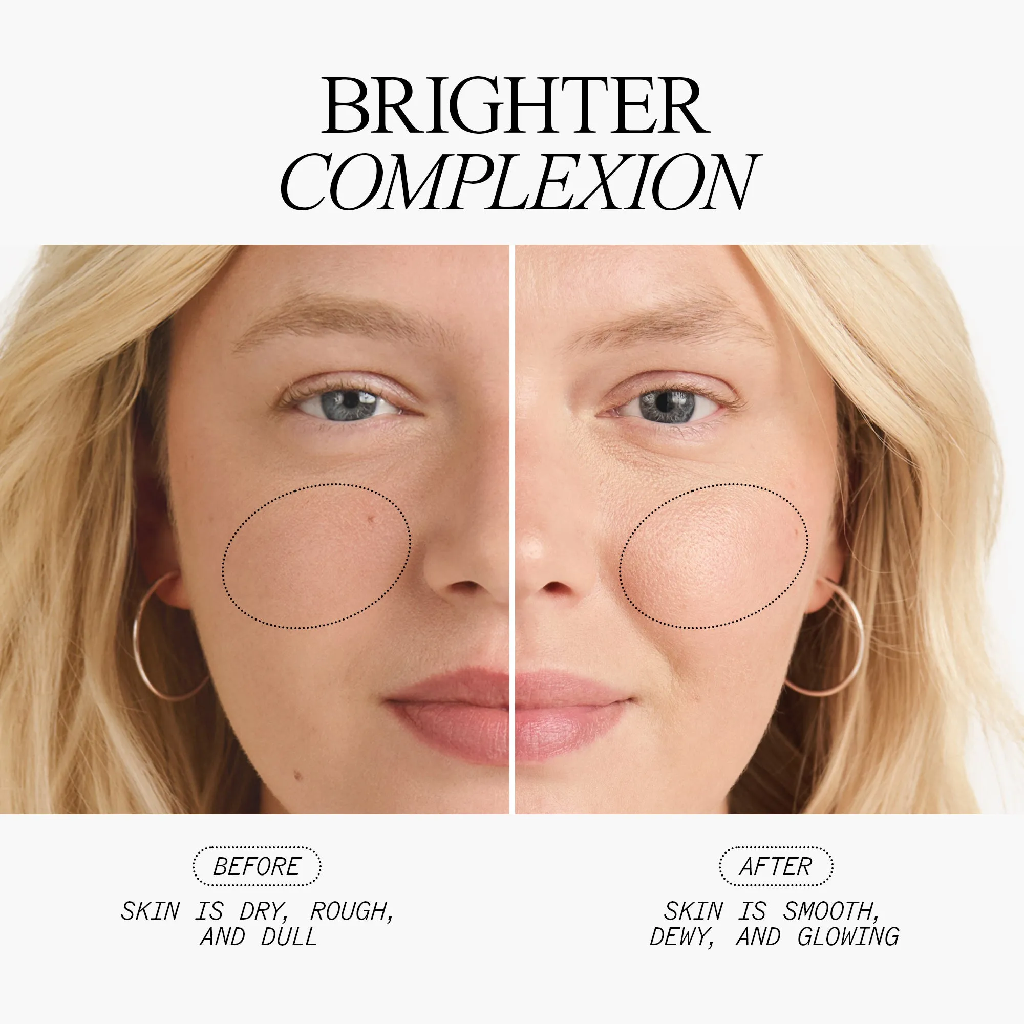 Complete Brightening System