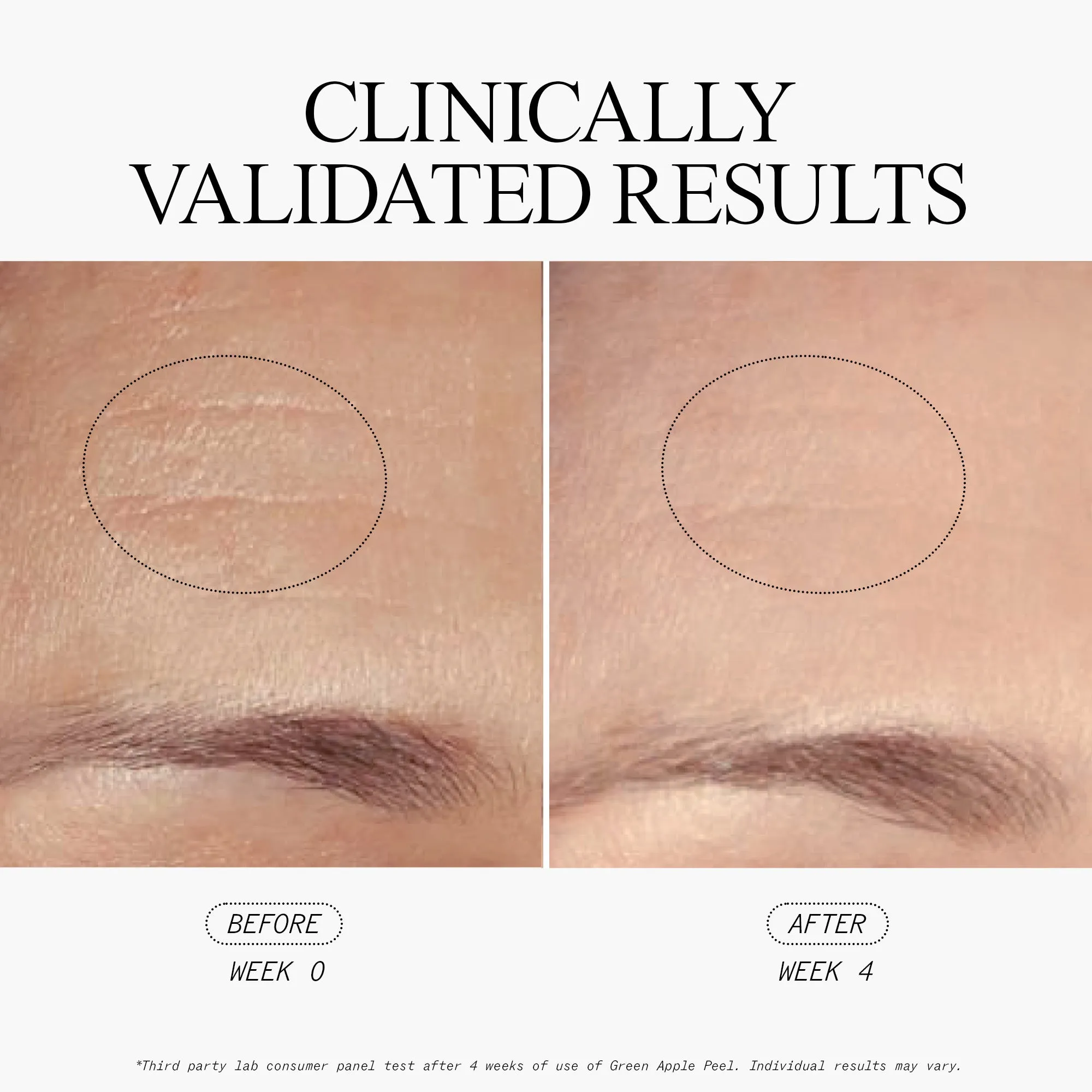 Complete Brightening System