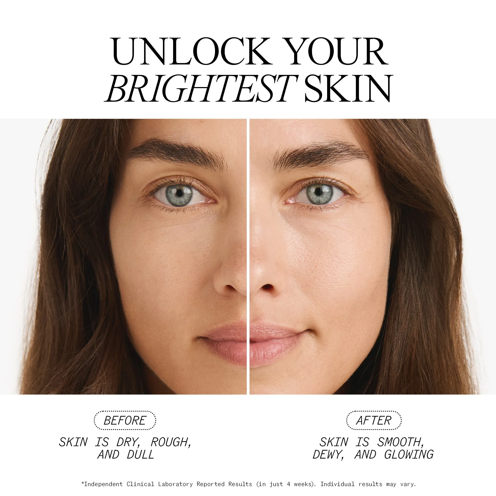 Complete Brightening System