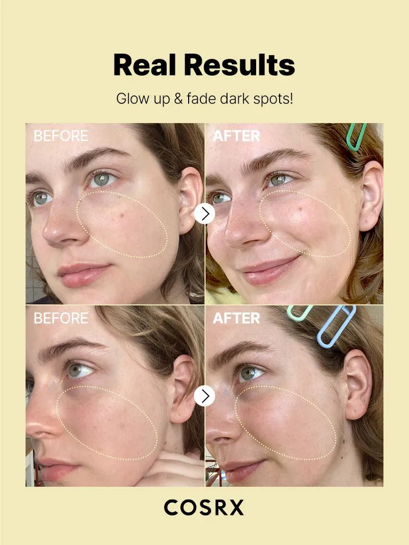 COSRX The Vitamin C 23 Serum Super Vitamin E   Hyaluronic Acid  سيروم فيتامين سي واي والهايلرونك اسد من كوزركس