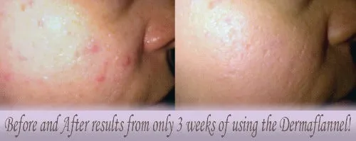 Dermaflannel® Exfoliator for Face & Body