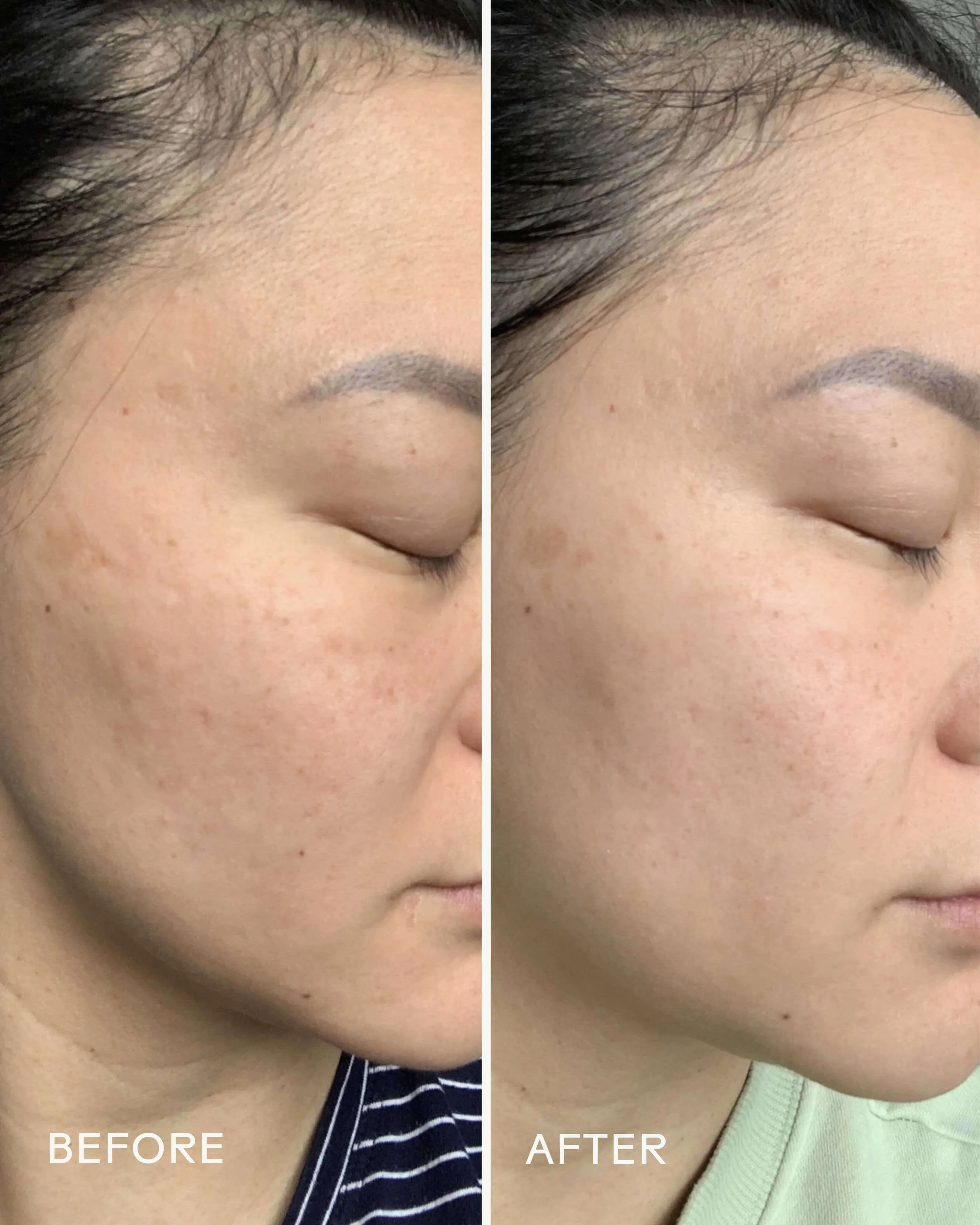 Dew Drops Mushroom Hyaluronic Acid   Vitamin C Serum