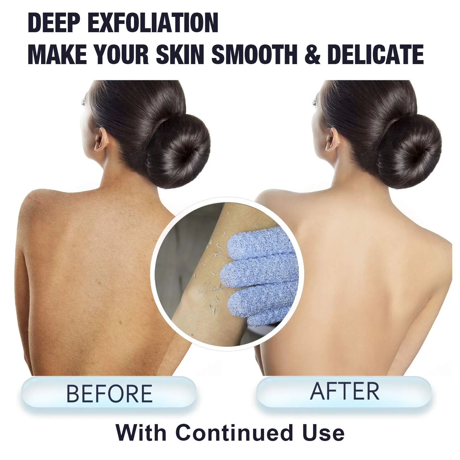 EvridWear Exfoliating Dual Texture Bath Gloves for Shower, Spa, Massage and Body Scrubs, Dead Skin Cell Remover (2 Pairs Moderate)
