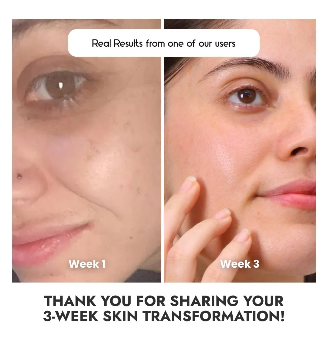 Glowing Skin with Vitamin C-23% Serum : Advanced Molecular Skincare Technology