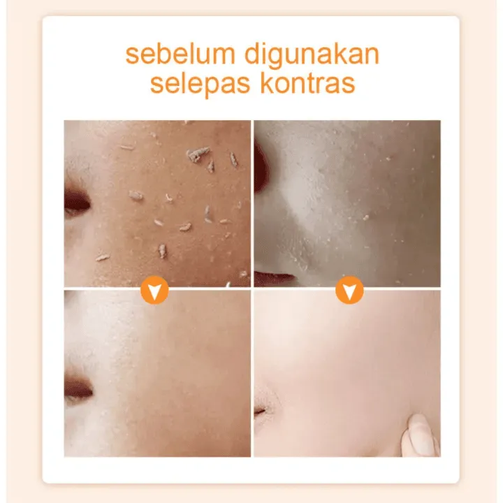 Gmeelan Orange Exfoliating Whitening Gel - 50g