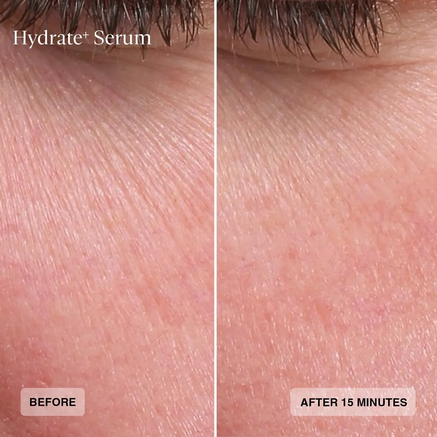 Hydrate  Serum