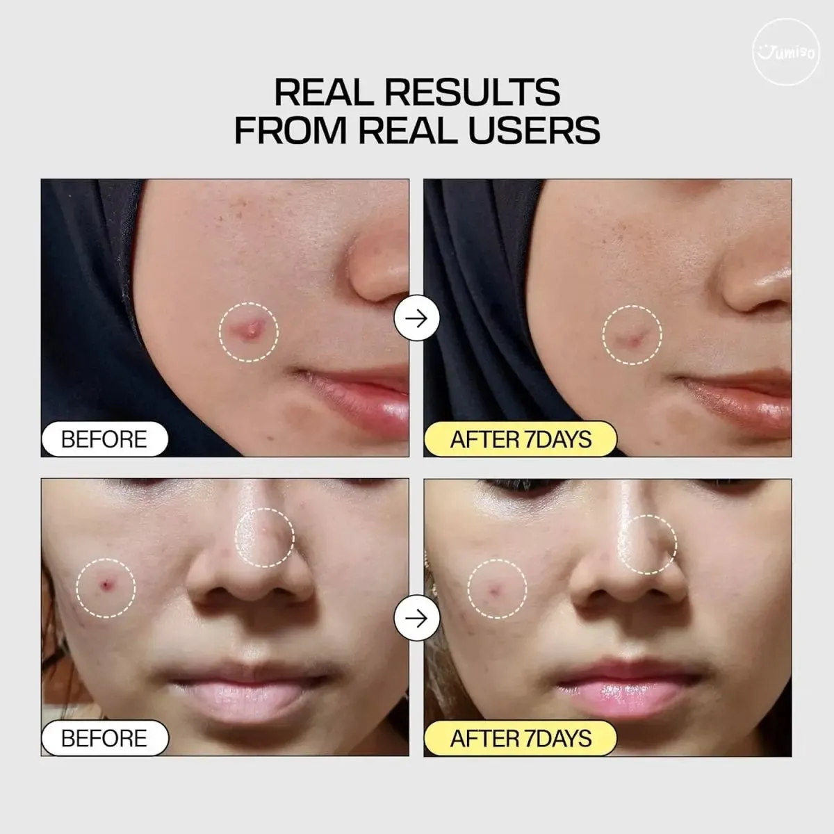 JUMISO Snail Mucin 95   Peptide Facial Essence 140 ML