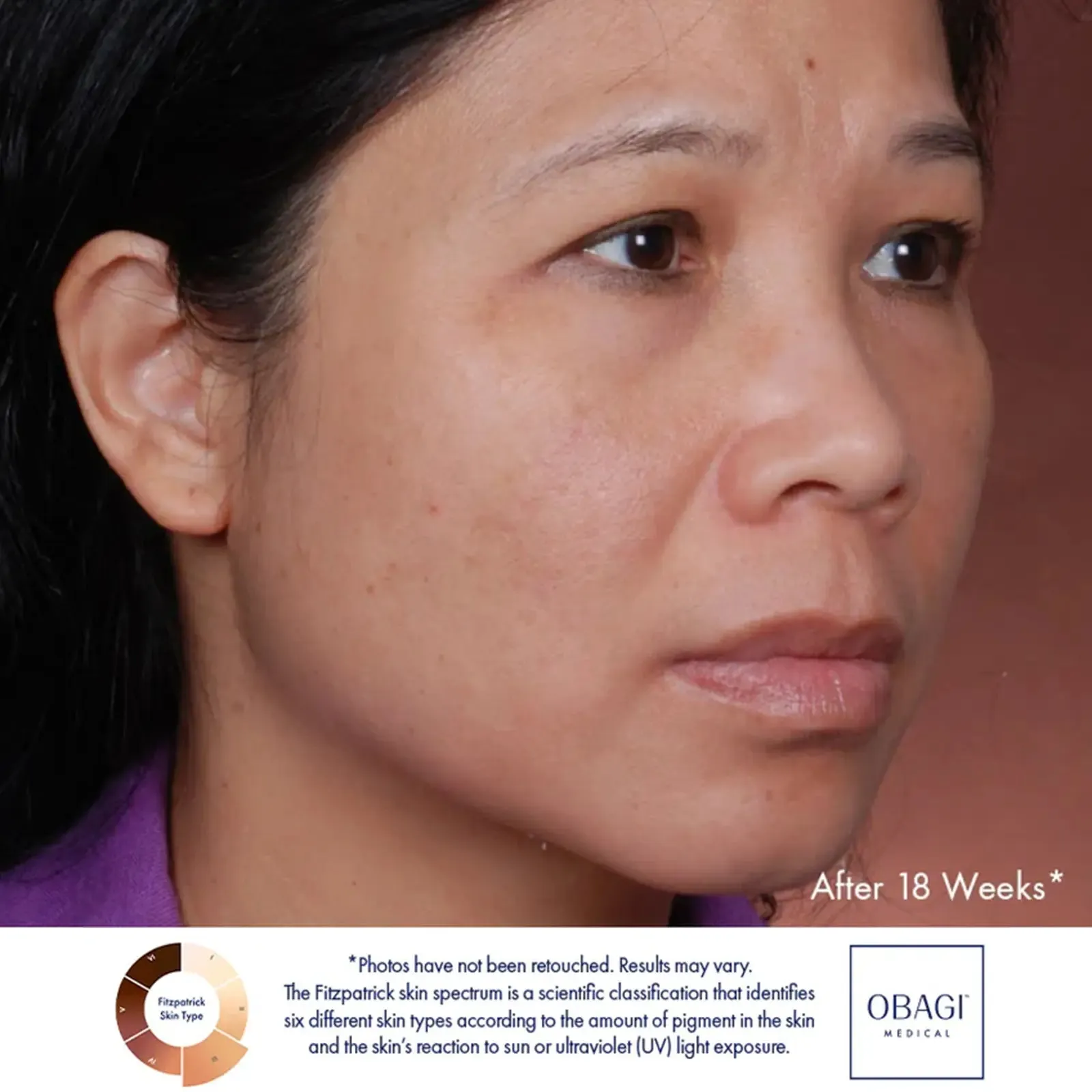 Obagi: Nu-Derm® Blend Fx 57g