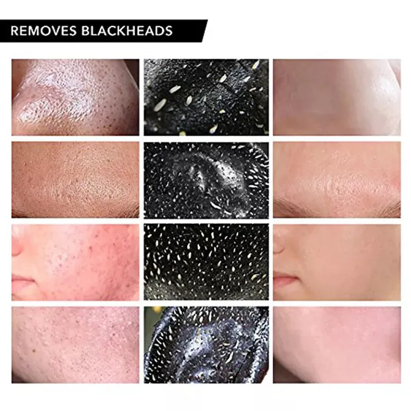 Peel off blackhead mask