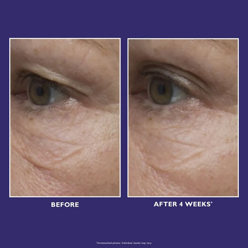 Peter Thomas Roth Ultimate Solution 5 Multitasking Eye Cream