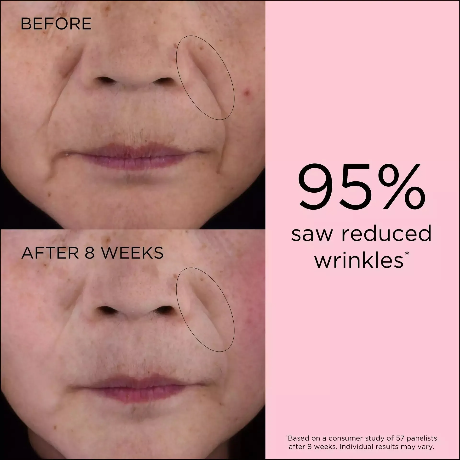Retinol   HPR Ceramide Capsules Rapid Skin Renewing Serum and Eye Cream Set