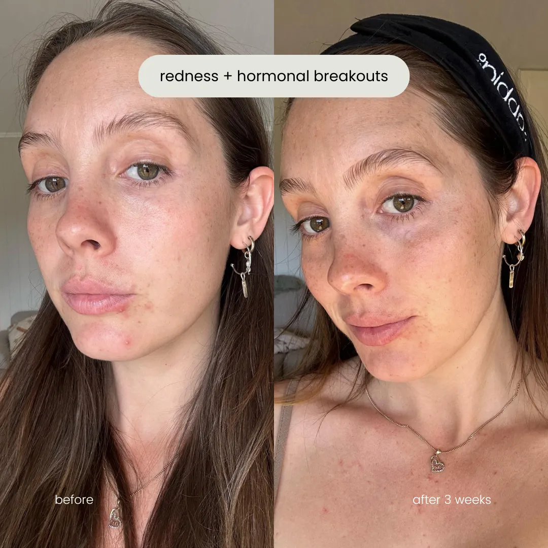skin starter kit   mineral bb cream