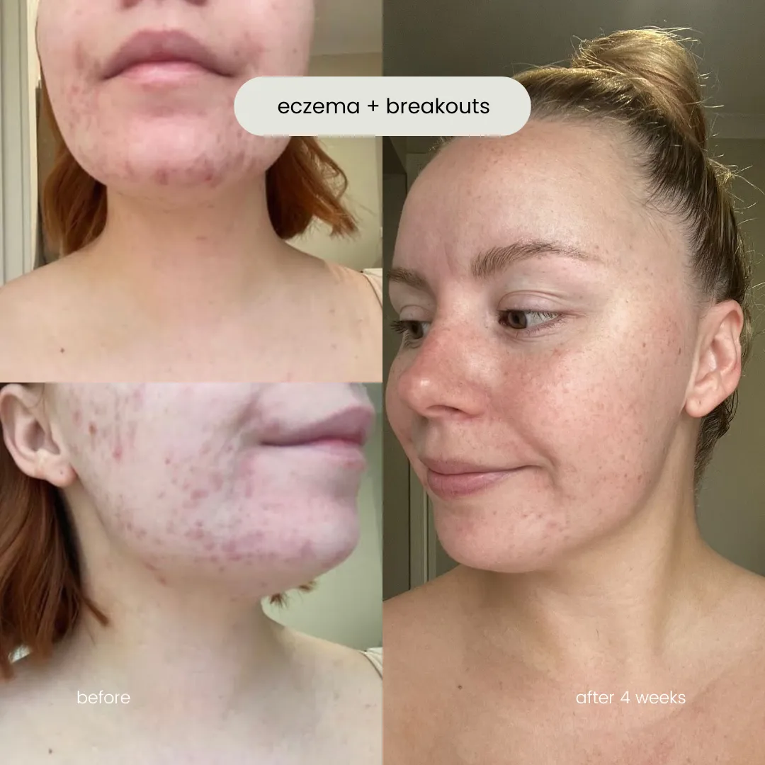 skin starter kit   mineral bb cream