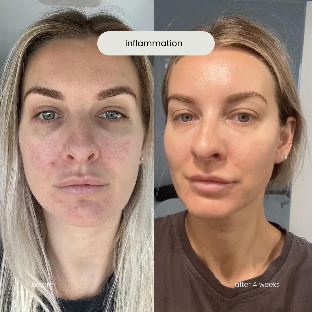 skin starter kit   mineral bb cream