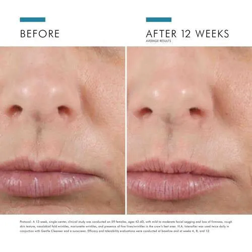 SKINCEUTICALS - HA INTENSIFIER 30M