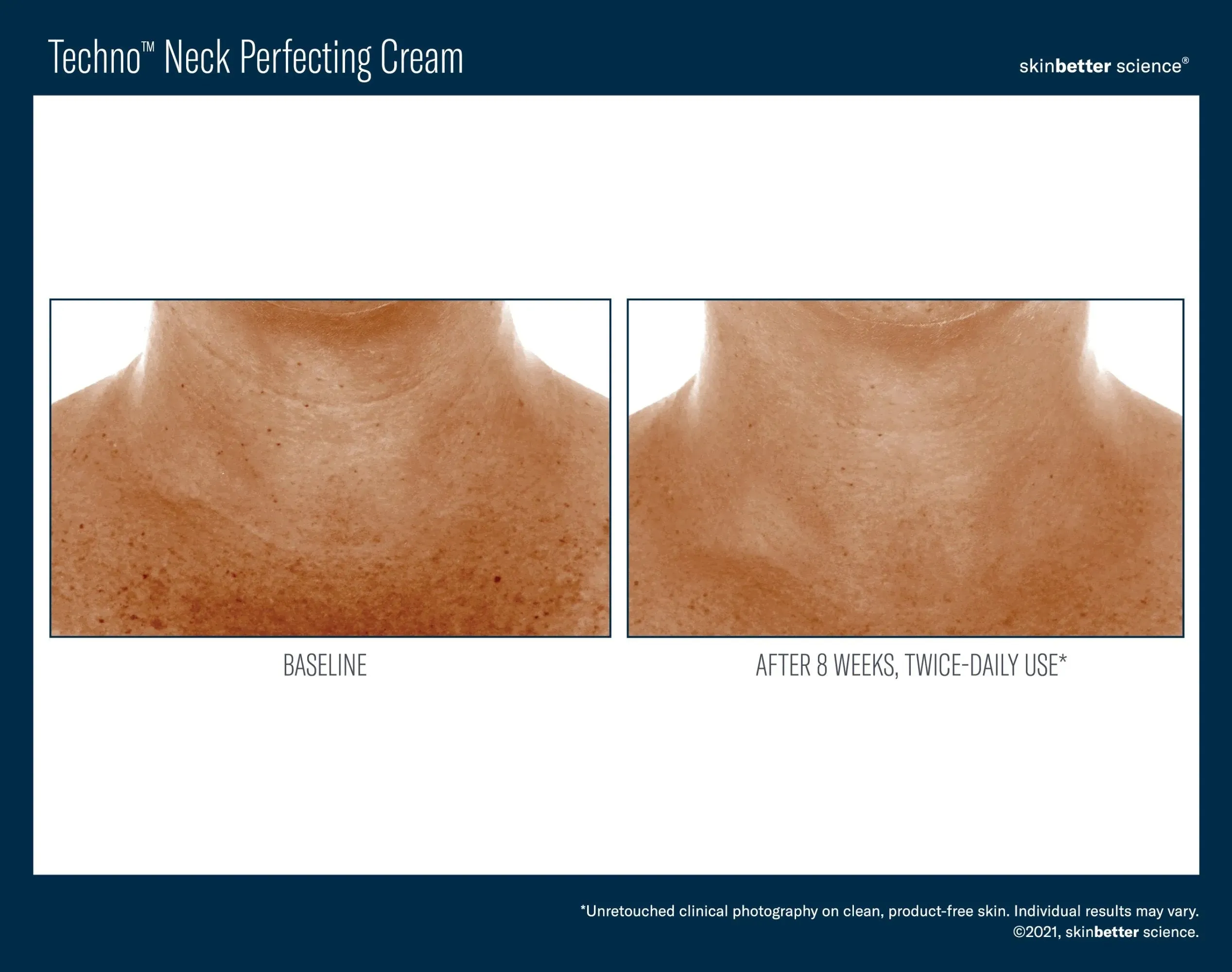 Techno Neck Perfecting Cream