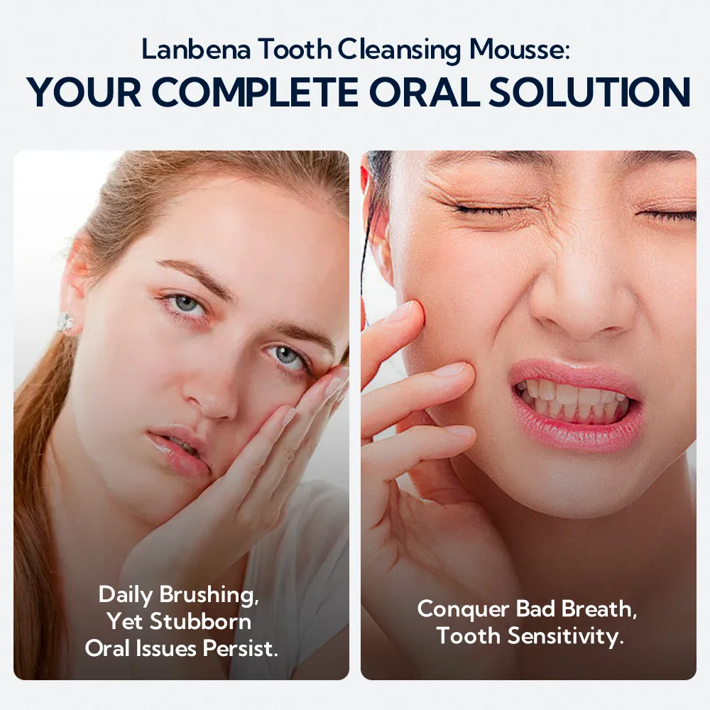 Teeth Whitening Mousse