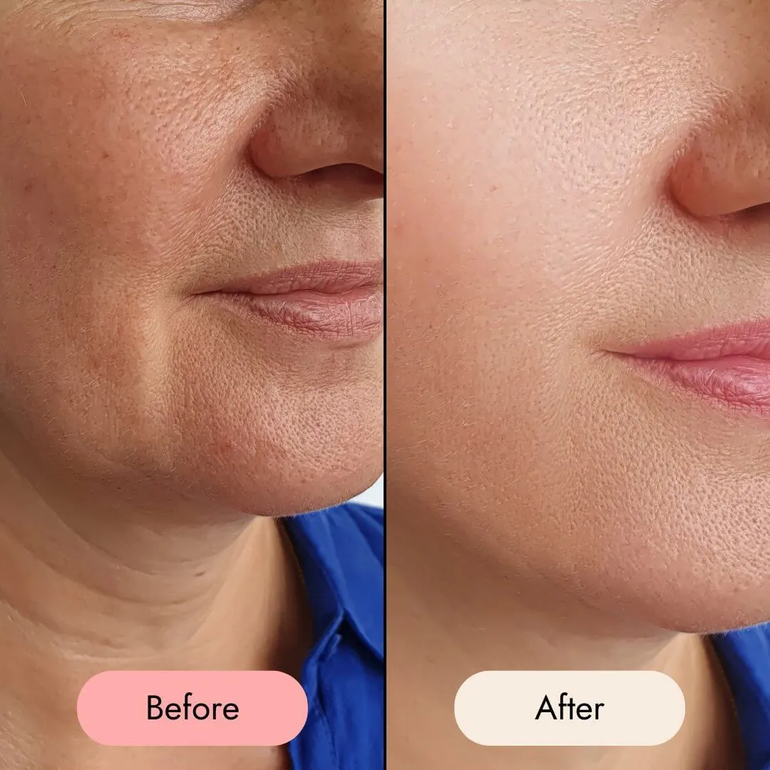 Vitamin C Serum